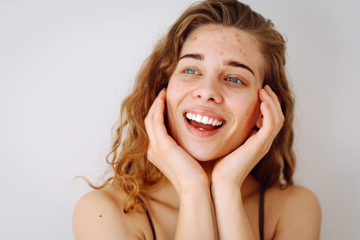 Blemishes & Congestion