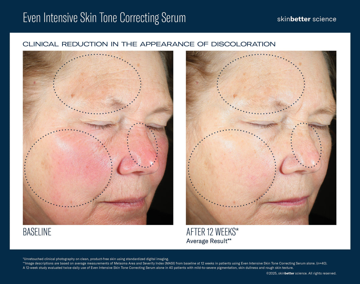 Even Intensive Skin Tone Correcting Serum 50 ml