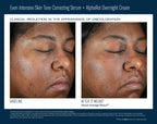 Even Intensive Skin Tone Correcting Serum 50 ml