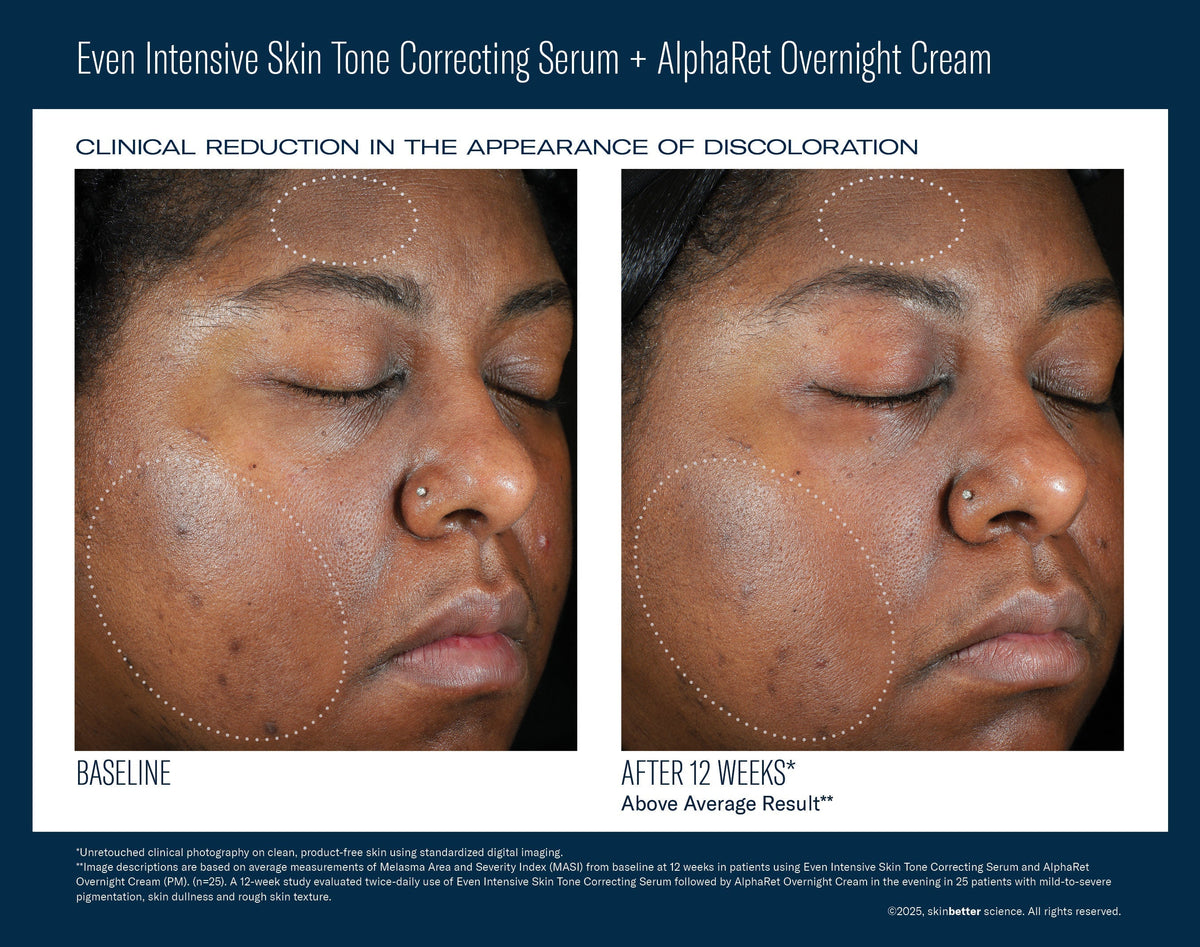 Even Intensive Skin Tone Correcting Serum 50 ml