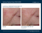 InterFuse Treatment Cream FACE & NECK 50 ml