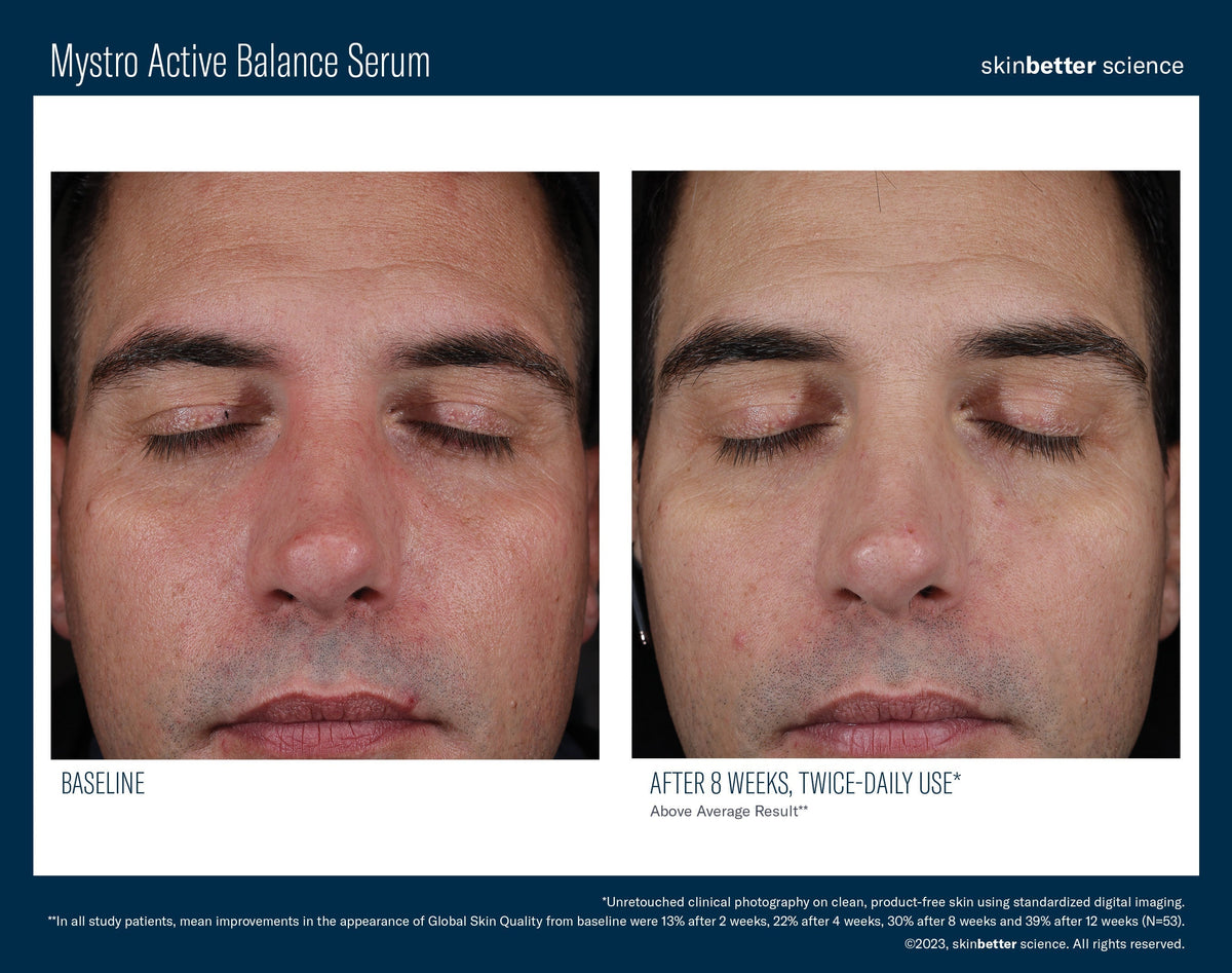 Mystro Active Balance Serum 30 ml