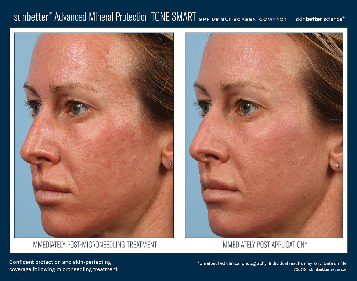 SunBetter TONE SMART SPF 68 Sunscreen Compact