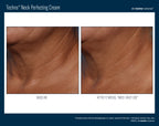 Techno Neck Perfecting Cream 50 ml