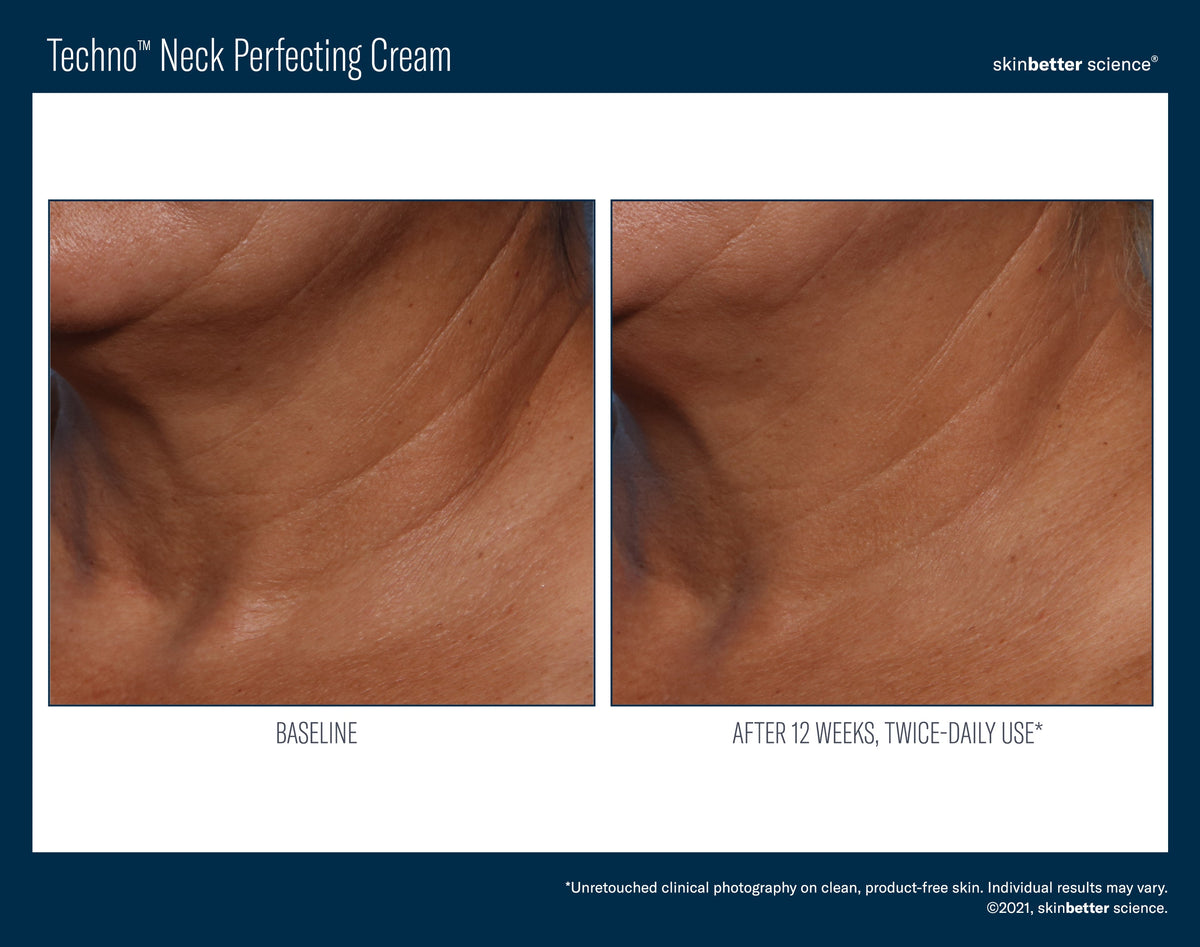 Techno Neck Perfecting Cream 50 ml