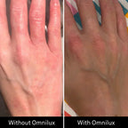 Omnilux Contour Glove