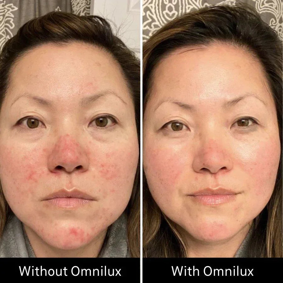 Omnilux Contour Face